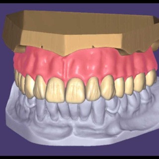 exocad-3shape-cerec expert, telegram channel